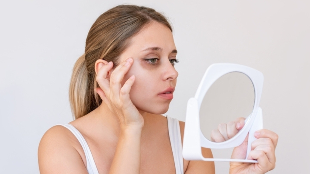 Μαύροι κύκλοι – Σύγχρονες θεραπείες