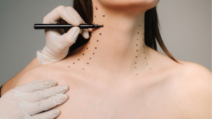 Ανόρθωση λαιμού