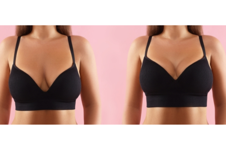 Μαστοπηξία